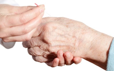 Acupuncture For Seniors